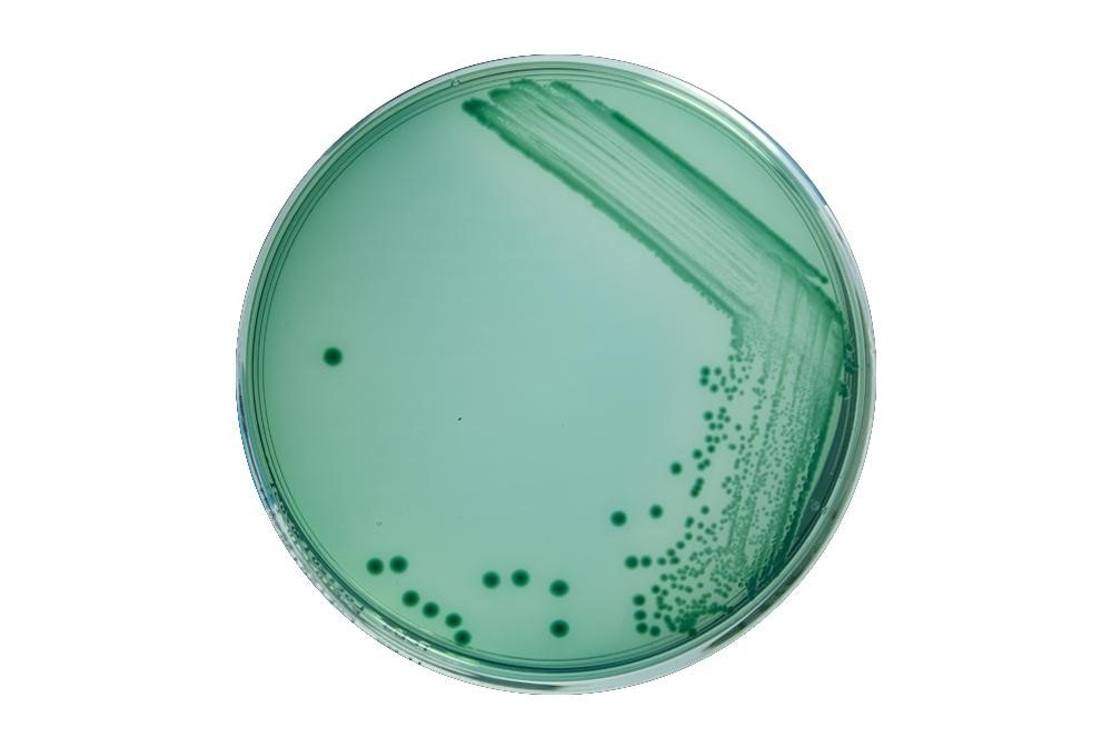 TCBS cấy Vibrio parahaemolyticus
